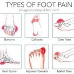 Types Of Foot Pain