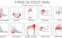 Types Of Foot Pain